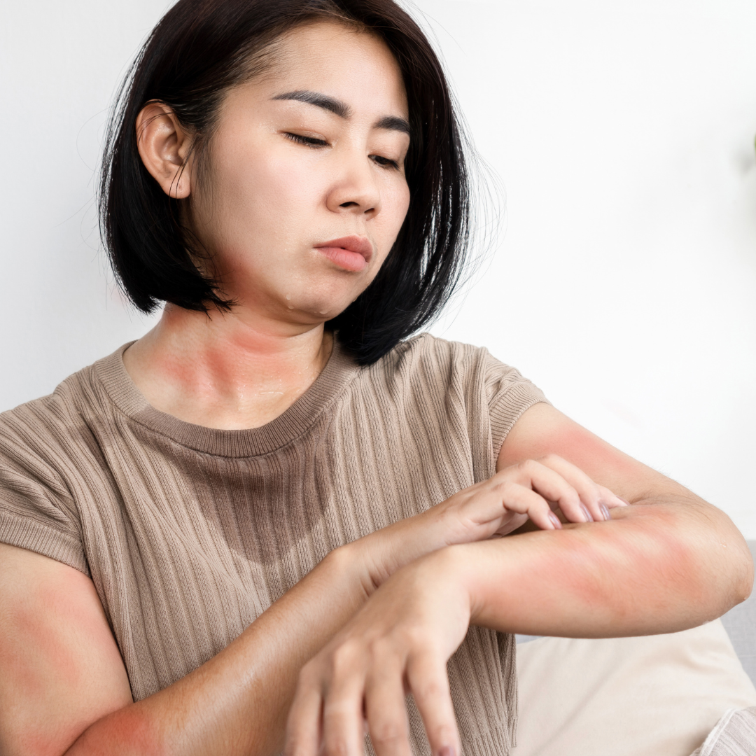 Psoriasis-atau-Eksim-Kenali-Perbedaannya-agar-Tepat-Menangani.png