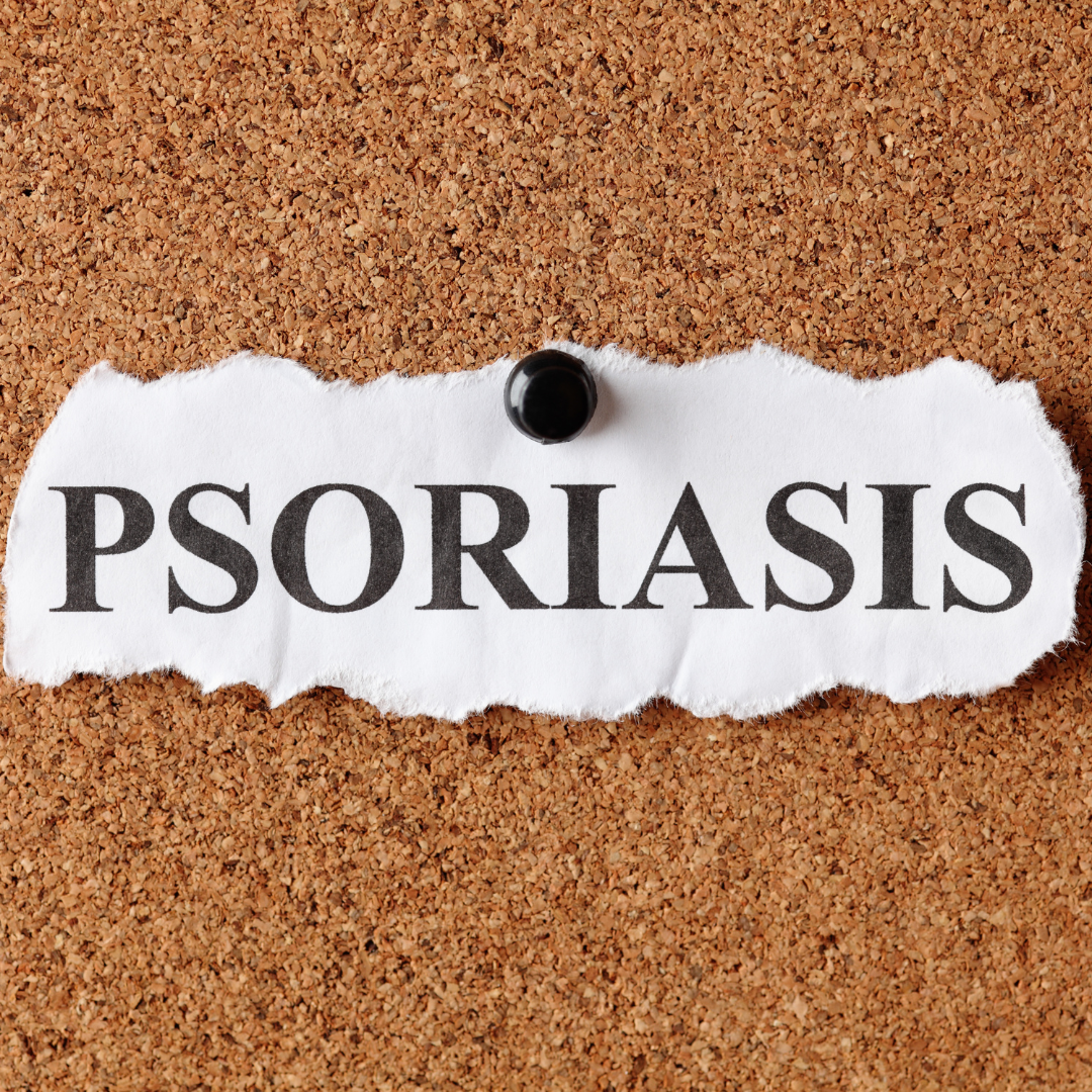 Tips-Mencegah-Psoriasis-Kambuh-dengan-Perawatan-Sehari-hari.png