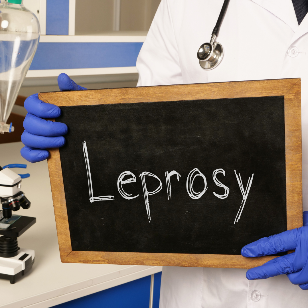 Kusta-Lepra-Cara-Penularan-Pencegahan-dan-Dukungan-bagi-Pasien.png